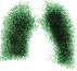 varredura do pulmão com criptônio-81m
