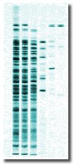 resultado de um experimento de eletroferese