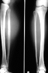 Radiografia de raios-X dos ossos